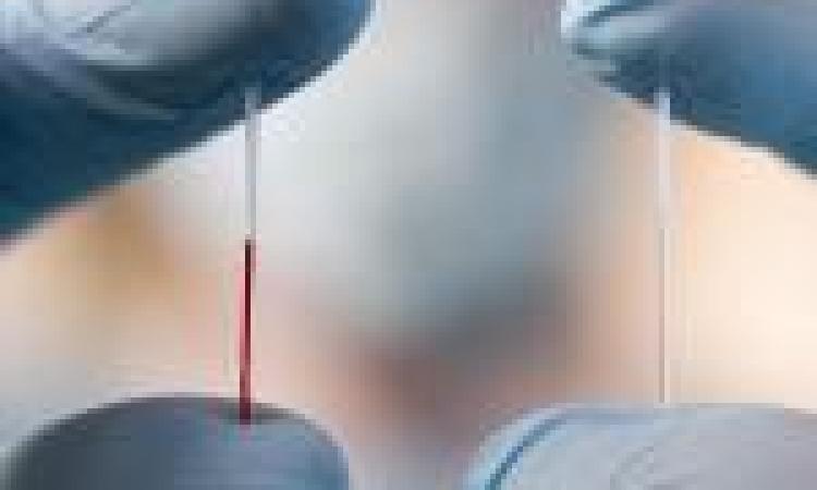 Interstitial fluid 