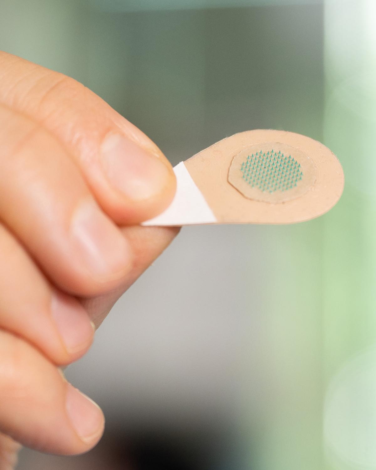 microneedle patch